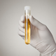 Illustration for article titled No, Your Urine Is Not Sterile